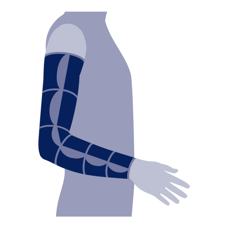Armdeel kort